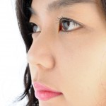 Rhinoplasty
